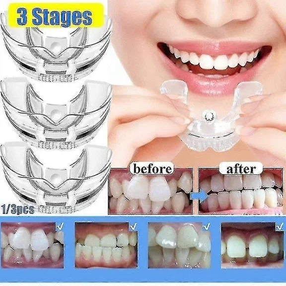 GTB Dental Orthodontic Teeth Corrector Silicone Braces Retainer Straighten Tools Teeth Capped for Adults
