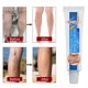 thumbnail image 5 of 20g crema varicosa crema para venas varicosas flebitis angitis eliminación piernas venas ungüento, 5 of 8