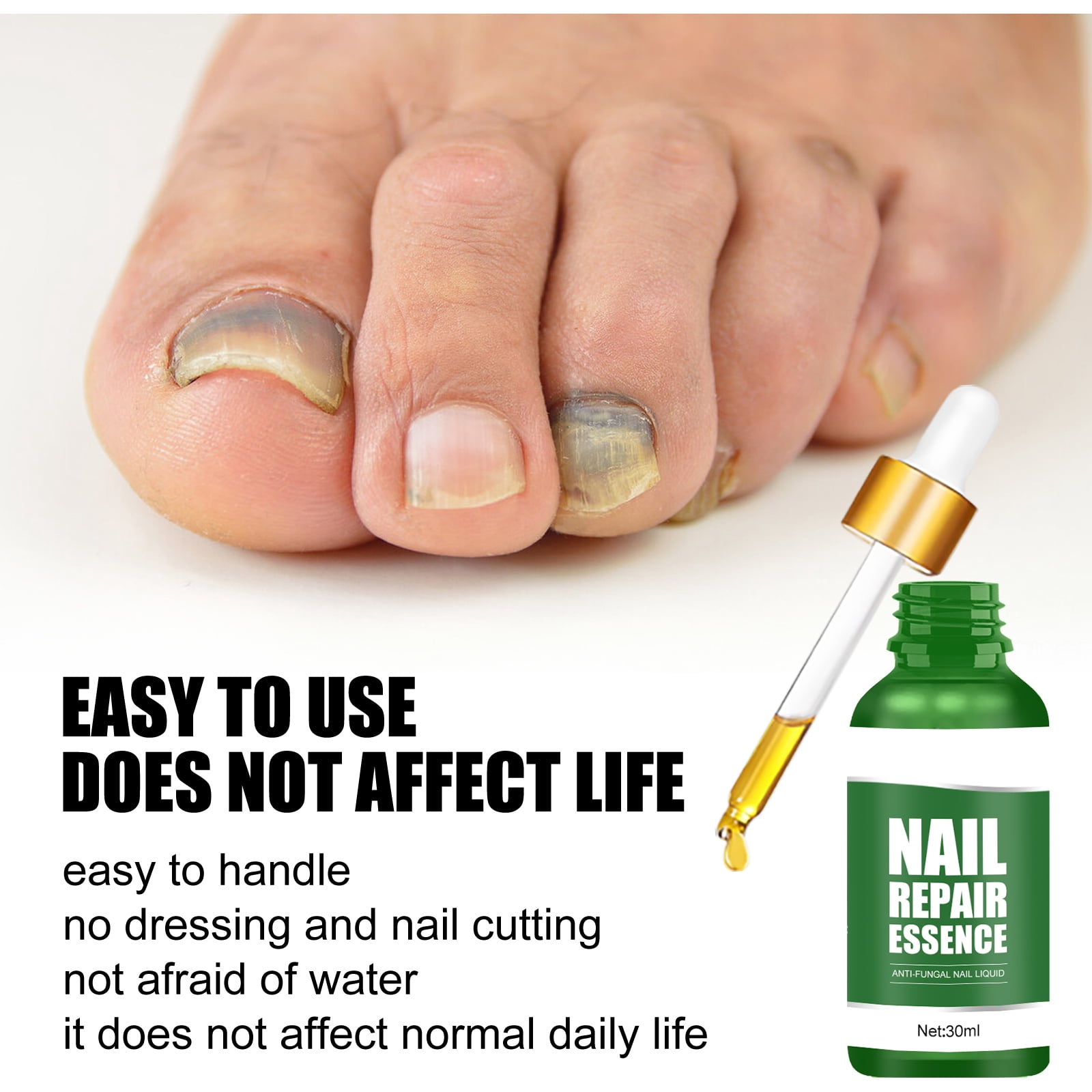 Alvantor Toenail Fungus Treatment Serum - Nail Repair Essence, 1.01 fl oz