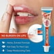 thumbnail image 4 of 1-5x 20g Cheilitis Treatment Cream for Dry Chapped Cracked Peeling and Bleeding, 4 of 5