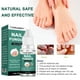 thumbnail image 1 of Reparación La Uñas Onchomicosis Fluid 10 Ml Safe Bactericida Natural Multipropósito para Cuidado Los Pies, 1 of 9
