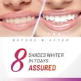 White Glo Accelerator Teeth Whitening Kit with LED Light for Sensitive