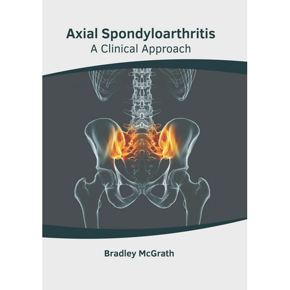 Axial Spondyloarthritis: A Clinical Approach, (Hardcover)