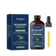 thumbnail image 1 of Rosemary Hair Care Essential Oil Nourishes, Softens And Rejuvenates Hair Daily, 1 of 5