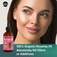 thumbnail image 5 of Kisskin ZitZap Parches para espinillas/acné para rostro y piel Parches hidrocoloides con ácido salicílico y aceite de árbol de té para cubrir granos e imperfecciones., 5 of 5