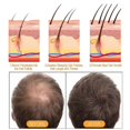 thumbnail image 3 of Champú anticaída de jengibre Cabello fuerte Reparación nutritiva de raíces del cabello Champú sólido anticaída para el crecimiento del cabello | 3270405964802, 3 of 5