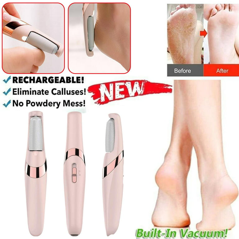 Rechargeable Electric Callus Remover Tool For An At-Home Spa