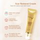 thumbnail image 5 of 30g Scar Gel Acne Scar Removal Cream For Removing Old Scars Burns, Cuts And Stretch Marks On Face And Body ANGGREK Scar Gel, 5 of 8