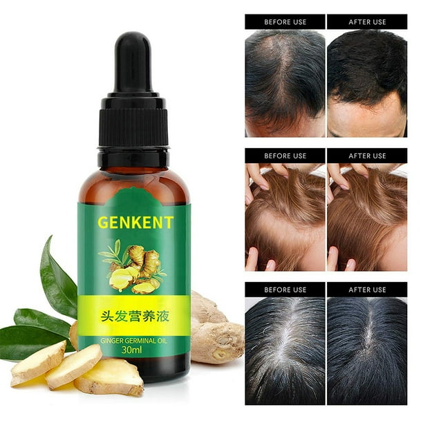 Genkent Ginger Germinal Serum, Ginger Hair Growth Serum, Ginger