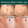 thumbnail image 4 of Silicone Sheets - Sheets For C-section, Tummy Tuck, Keloid, And Surgical Scars - Reusable Grade Silicone Sheets, 4 of 4