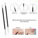 thumbnail image 3 of Tool Kit, Professional Acne Treatment Tool Acne Kit Acne Needles (1 Set - Black), 3 of 5