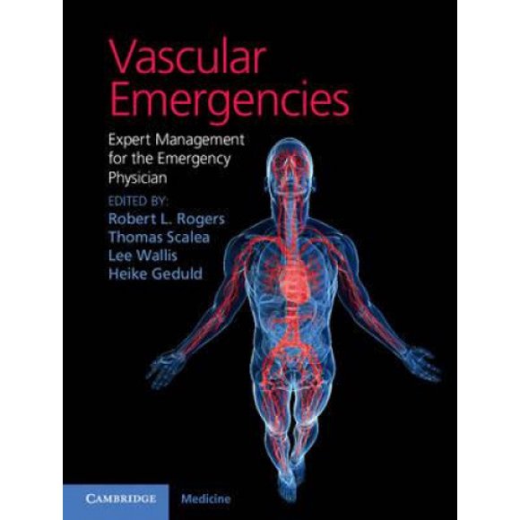 Vascular Emergencies: Expert Management for the Emergency Physician