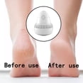 thumbnail image 4 of 2/1 Sets Foot Grinder,Wireless Portable Electric Foot Grinder, Electric Foot Callus Remover, 2 Speed Levels & 2 Grinding Heads, Skin Trimmer Dead Skin, 4 of 9