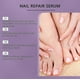thumbnail image 4 of Tea Tree Oil Infused Nail Treatment Softens and Strengthens Brittle Nails While Minimizing Breakage, 4 of 5