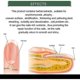 thumbnail image 5 of Aceites antimicóticos para tratamientos de uñas de calidad médica, Aceites antimicóticos para tratamientos de uñas, 3 unidades, 5 of 5
