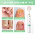 thumbnail image 2 of 1-3pcs Nail Care PenThe Original, Nail Fungus Pen Austria, Nail Care Pen Cosmetic Care for Nail Fungal Infection, 2 of 5