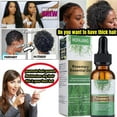 thumbnail image 6 of Rosemary Oil for Hair Growth, 100% Pure Natural Organic Rosemary Essential Oil, Biotin Hair Growth Serum for Hair Loss Regrowth Treatment，Nourishment Scalp, Stimulates Hair Growth (2 PCS), 6 of 9