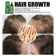 thumbnail image 5 of Spray para el crecimiento del cabello, hidratante y espesante, tratamiento profesional para el recrecimiento del cabello., 5 of 5