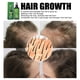 thumbnail image 5 of Spray para el crecimiento del cabello, Spray hidratante para espesar el cabello, tratamiento profesional para el crecimiento del cabello, 5 of 5