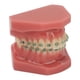 thumbnail image 3 of Modelo de soporte de ortodoncia dental BuyWeekMX Modelo de demostración de ortodoncia, 3 of 9