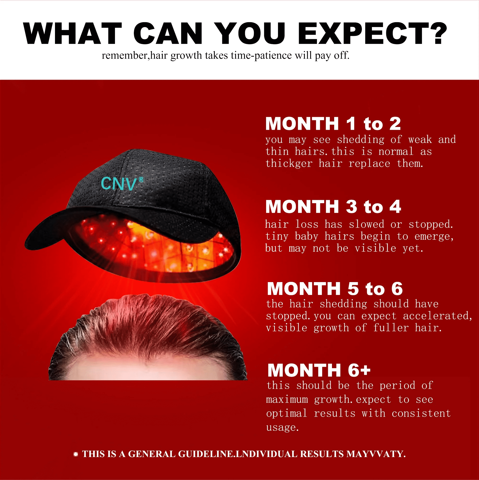 CNV Wearable Red Light Cap for Scalp Wellness, Discreet Hands-Free Light Device with Flexible Insert for At-Home Hair Care Routines, Portable & Rechargeable, White(108D)