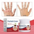 thumbnail image 1 of Skin Itch Cowhide Fresh Itch Skin And Lip Care Products, 1 of 8