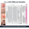 thumbnail image 2 of MRSXXNTY Professional Pimple Popper Tool Kit - 22 PCS Blackhead Remover Tools for Acne and Zit Popping Comedone Extractor with Magnifying Glass and Alcohol Pad, 2 of 5