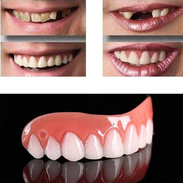 Kilkwhell Professional Perfect Smile Veneers Dub In Stock For Correction Of Teeth For Bad Teeth