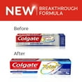 thumbnail image 3 of Colgate Total Advanced Whitening Toothpaste with Fluoride, Multi Benefits with Sensitivity Relief, 5.1 Oz, 2 Ct, 3 of 14