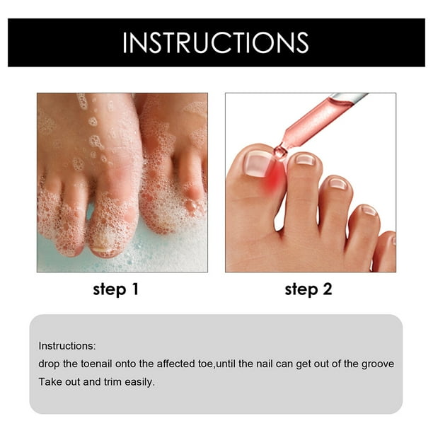 Dr scholl's shop ingrown toenail walmart