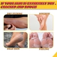 thumbnail image 3 of Crema De Pies Banana Cream Anti-Secado Suave Talón Agrietado Reparación Pie Eliminación de Piel Muerta Ygjytge Cuidado Belleza, 3 of 9
