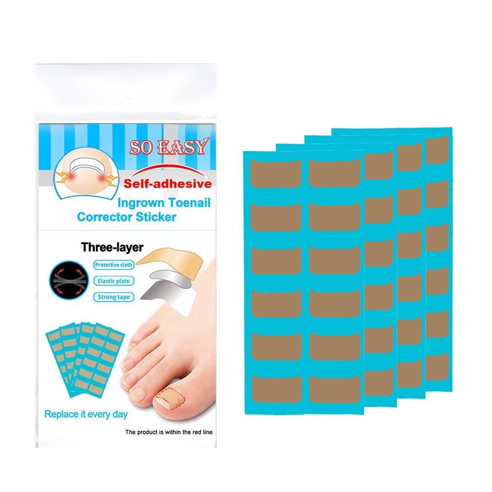 Ingrown Toenails Patch Corrector Pedicure Tools Gluefree Ingrown