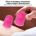 thumbnail image 3 of Ventosas de masaje Reducción del estrés de silicona con ventosas de masaje para niños para tratamiento de raspado ANGGREK Otros, 3 of 8