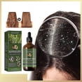 thumbnail image 2 of Aceite esencial de romero y menta para el cuidado del cabello Crecimiento del cabello Prevención de la rotura del cabello, 2 of 5