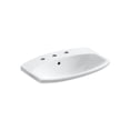 thumbnail image 2 of Kohler K-2351-8 Cimarron 20-3/8" Drop In Bathroom Sink - Grey, 2 of 6