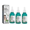 thumbnail image 1 of Fresh Breath Essence Removes Mouth Odor Fresh Breath Oral Cleaning Care Essence -, 1 of 4