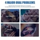 thumbnail image 4 of 1-3X Tartar Remover For Dog Natural Dental Care Solution Foam Remove Calculus Reduce Tartar Plaque Buildup Pets Oral Cleaning Product, 4 of 5