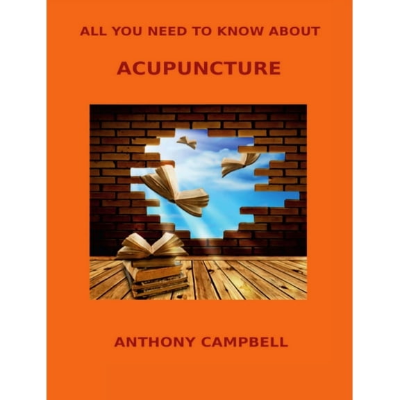 All You Need to Know About Acupuncture, (Paperback)