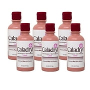 (6 pack) Calamine Lotion by Caladryl, Skin Protectant plus Itch Relief, 6 Fl Oz