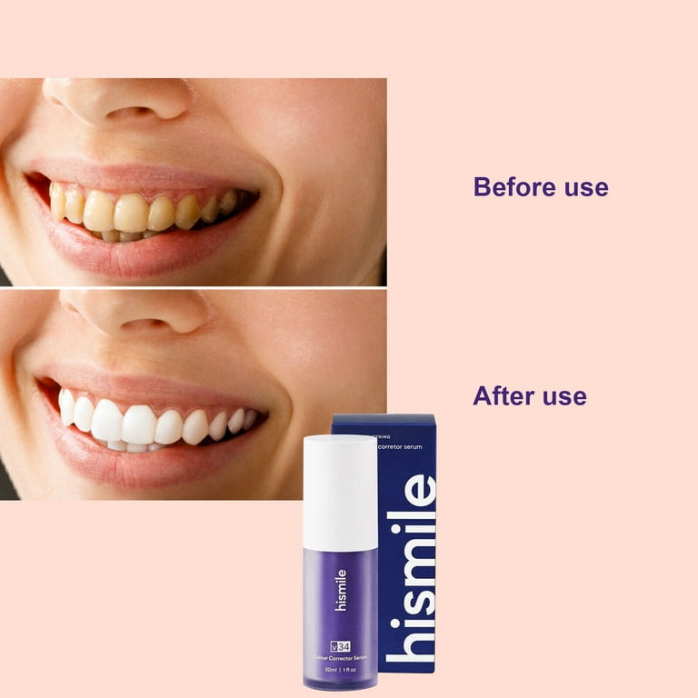 Hismile v34 Colour Corrector, Purple Teeth Whitening, Tooth Stain