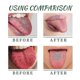 thumbnail image 4 of 30ml Tongue Repair Oral Health Spray, Dry Mouth Relief Spray Gentle, Oral Care Solution for Freshing Breath Comfort for Men & Women, 4 of 5