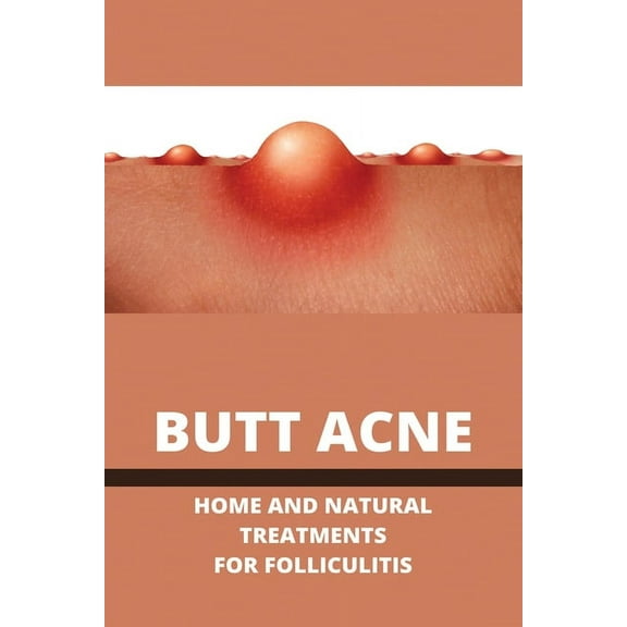 Butt Acne: Home and Natural Treatments for Folliculitis (Paperback)