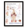 thumbnail image 1 of Understanding Arthritis Framed Medical Educational Poster Informational Diagram Doctors Office School Classroom 22x28 Inches, 1 of 4