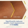 thumbnail image 3 of Nivea Luminous 630 Anti-Stretch Mark Body Oil Serum 100ml / 3.4 fl oz, 3 of 3