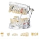 thumbnail image 1 of Modelo de Dientes Enfermos Tipodontos Dentales Modelo de Dientes de Implante con Dientes Removibles Demostración de Dientes Estándar del Dentista, 1 of 5