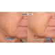 thumbnail image 5 of Soufflé hidratante NASSIF MD Hydro-Screen para rostro y cuerpo 120 ml, 5 of 7