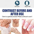 thumbnail image 5 of HYLLai Nail Repair Cream for Soft and Damaged Nails, Helps Improve Nail Appearance, Moisturizing Treatment for Hands and Feet, 20g, 5 of 6