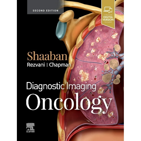 Diagnostic Imaging Diagnostic Imaging: Oncology, (Hardcover)