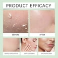 thumbnail image 4 of QUIA Zero Pore Pads Trgets Large Pores and Uneven Tone Korean Skincare 70pcs, 4 of 5
