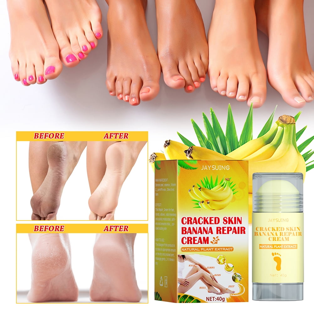 Banana Repair Foot Cream, Anti-cracking Dry Feet Balm, 30g Cracked Heel  Moisturizer, Foot Repair Moisturizing Remove Dead Skin, Foot Care Products  F